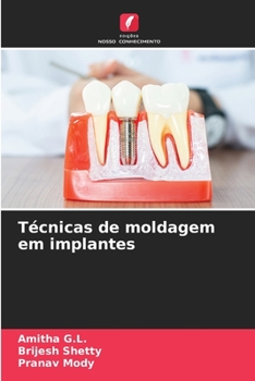 Paperback Técnicas de moldagem em implantes [Portuguese] Book