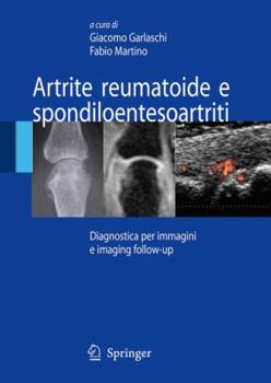 Hardcover Artrite Reumatoide E Spondiloentesoartriti: Diagnostica Per Immagini Ed Imaging Follow-Up [Italian] Book