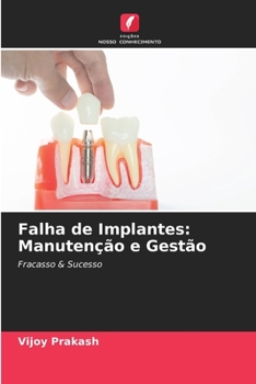 Paperback Falha de Implantes: Manutenção e Gestão [Portuguese] Book
