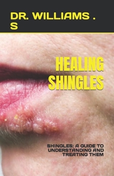 Paperback Healing Shingles: Shingles: A Guide to Understanding and Treating Them Book