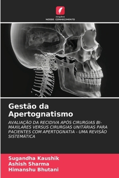 Paperback Gestão da Apertognatismo [Portuguese] Book