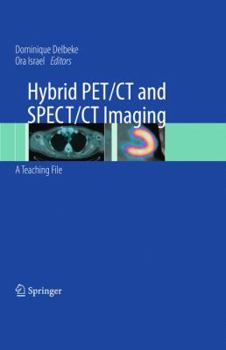 Hardcover Hybrid PET/CT and SPECT/CT Imaging: A Teaching File [With DVD] Book