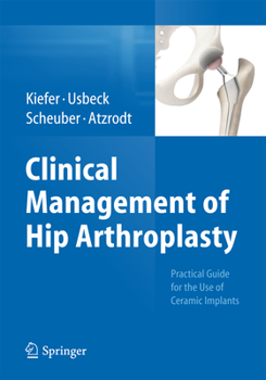 Paperback Clinical Management of Hip Arthroplasty: Practical Guide for the Use of Ceramic Implants Book