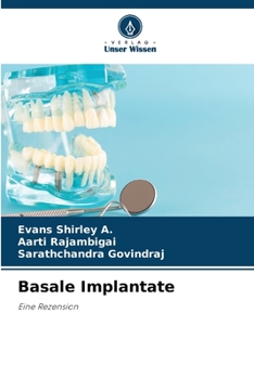 Paperback Basale Implantate [German] Book