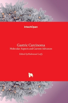 Hardcover Gastric Carcinoma: Molecular Aspects and Current Advances Book