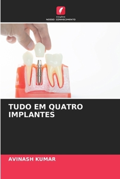 Tudo Em Quatro Implantes (Portuguese Edition)