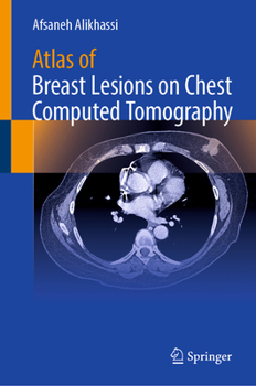 Hardcover Atlas of Breast Lesions on Chest Computed Tomography Book