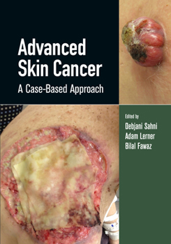 Advanced Skin Cancer: A Case-Based Approach