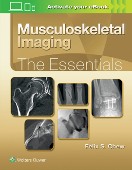 Hardcover Musculoskeletal Imaging: The Essentials Book