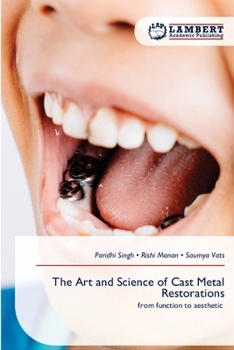 The Art and Science of Cast Metal Restorations