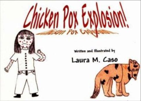 Paperback Chicken Pox Explosion! Book