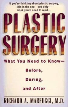 Paperback Plastic Surgery: What You Need to Know Before, During, and After Book