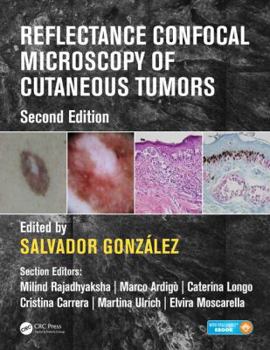 Hardcover Reflectance Confocal Microscopy of Cutaneous Tumors Book