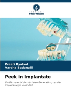 Paperback Peek in Implantate [German] Book