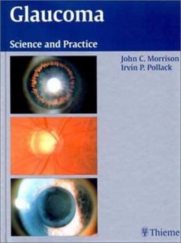 Hardcover Glaucoma: Science and Practice Book