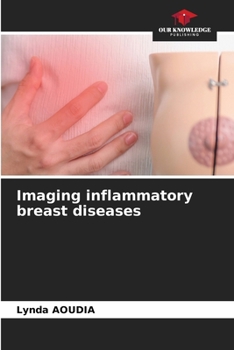 Paperback Imaging inflammatory breast diseases Book