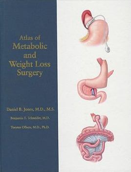 Hardcover Atlas of Metabolic and Weight Loss Surgery Book