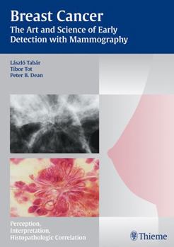 Hardcover Breast Cancer: The Art and Science of Early Detection with Mammography Book