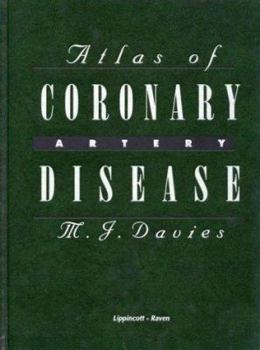 Hardcover Atlas of Coronary Artery Disease Book