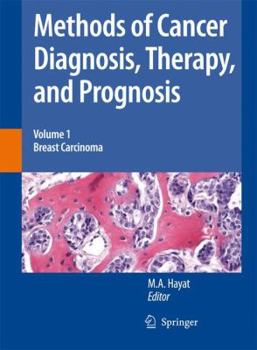 Paperback Methods of Cancer Diagnosis, Therapy and Prognosis: Breast Carcinoma Book