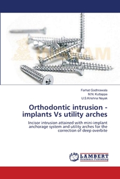 Paperback Orthodontic intrusion - implants Vs utility arches Book