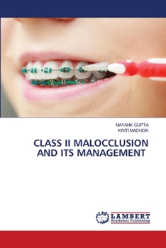 Paperback Class II Malocclusion and Its Management Book