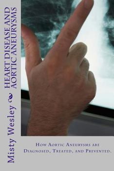Paperback Heart Disease and Aortic Aneurysms Book