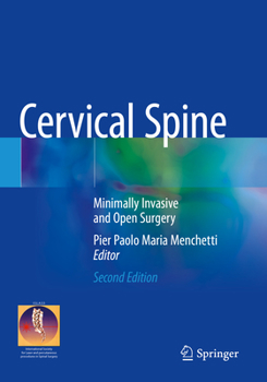 Paperback Cervical Spine: Minimally Invasive and Open Surgery Book