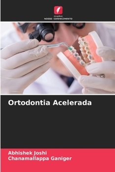 Paperback Ortodontia Acelerada [Portuguese] Book