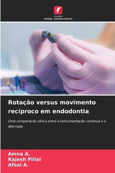 Rotação versus movimento recíproco em endodontia