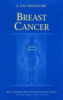 Paperback Breast Cancer Book