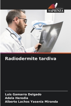 Paperback Radiodermite tardiva [Italian] Book