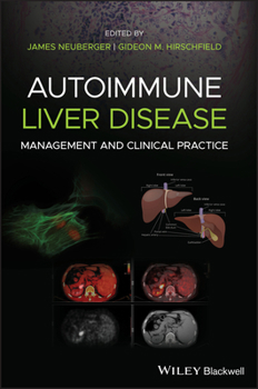 Hardcover Autoimmune Liver Disease: Management and Clinical Practice Book