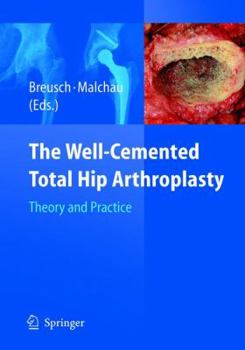 Hardcover The Well-Cemented Total Hip Arthroplasty: Theory and Practice Book