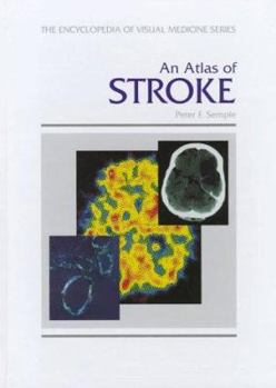 Hardcover An Atlas of Stroke Aration Book