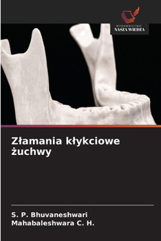 Zlamania klykciowe zuchwy (Polish Edition)