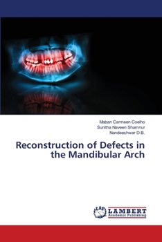 Paperback Reconstruction of Defects in the Mandibular Arch Book