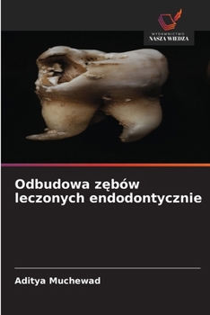 Paperback Odbudowa zębów leczonych endodontycznie [Polish] Book