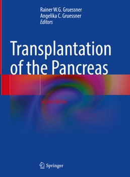 Hardcover Transplantation of the Pancreas Book