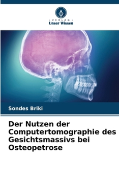 Paperback Der Nutzen der Computertomographie des Gesichtsmassivs bei Osteopetrose [German] Book