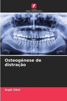 Paperback Osteogénese de distração [Portuguese] Book
