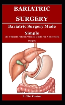 Paperback Bariatric Sugery Made Simple: The Ultimate Patient Practical Guide For A Successful Surgery Book