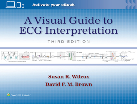 Paperback A Visual Guide to ECG Interpretation: Print + eBook with Multimedia Book