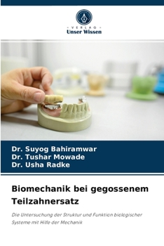 Paperback Biomechanik bei gegossenem Teilzahnersatz [German] Book
