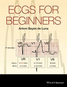 Paperback Ecgs for Beginners Book