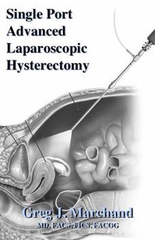 Paperback Single Port Advanced Laparoscopic Hysterectomy: An Advanced Ultra-Minimally Invasive Surgical Technique Book