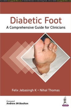 Paperback Diabetic Foot: A Comprehensive Guide for Physicians Book