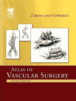 Paperback Atlas of Vascular Surgery - Paperback Edition Book