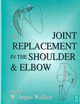 Hardcover Joint Replacement in the Shoulder and Elbow Book