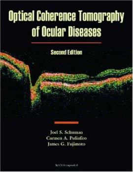 Hardcover Optical Coherence Tomography of Ocular Diseases Book